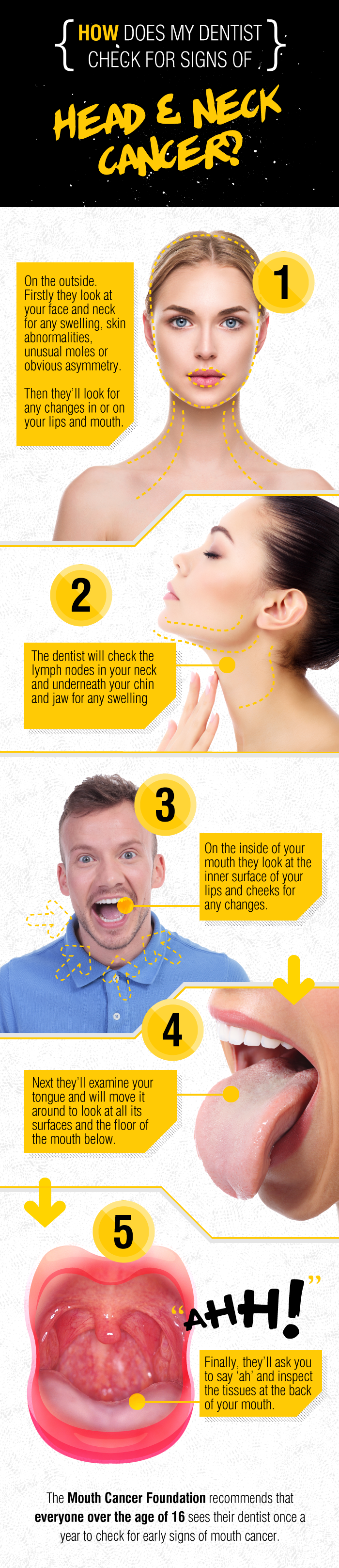 Mouth Cancer - Infographic